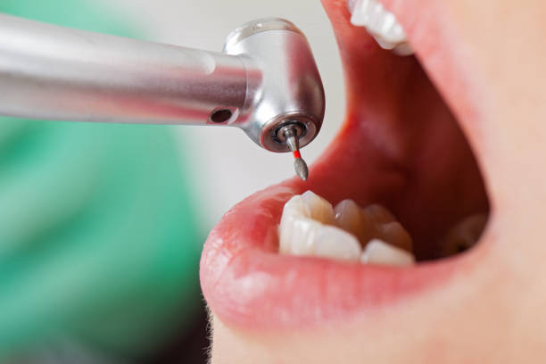 Best Knocked-Out Tooth Emergency  in Yeagertown, PA